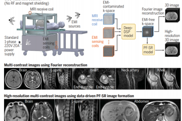 0.05T移動全身MR來了